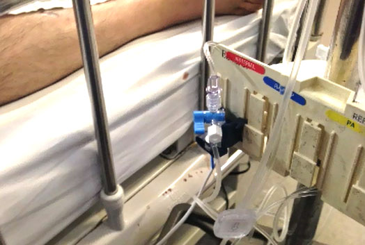 Auto Transducer
